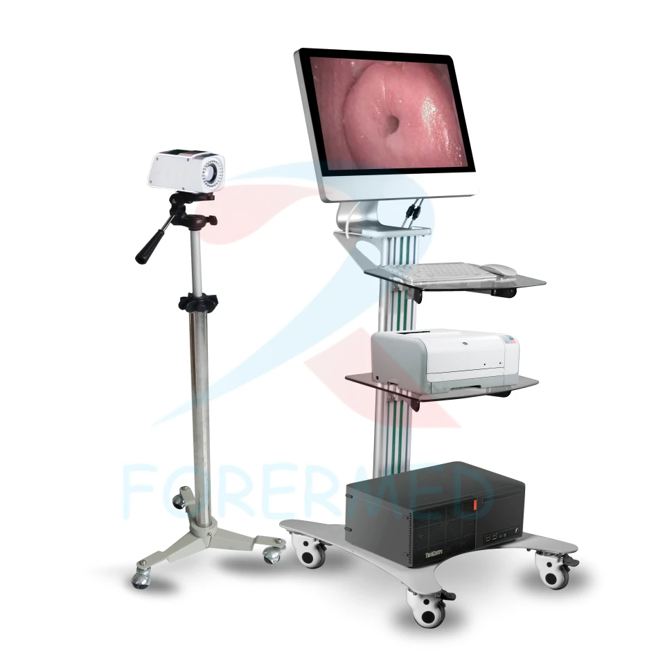 3302 colposcope 2 3302 colposcope 2