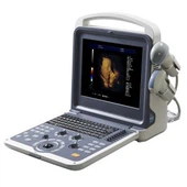 Digitalni prijenosni 4 3D USG color doppler u boji