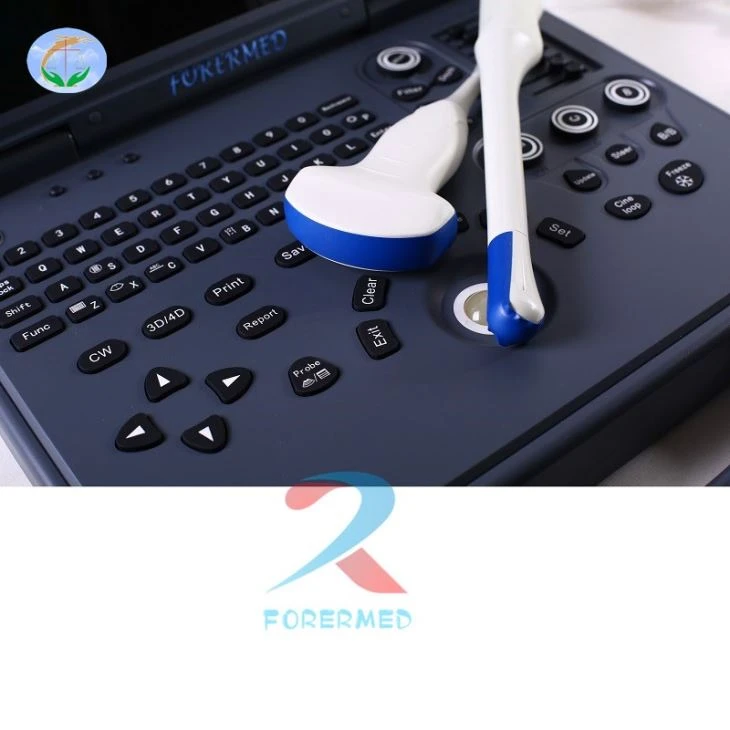 3D Doppler USG Scanner 3D Doppler USG Scanner