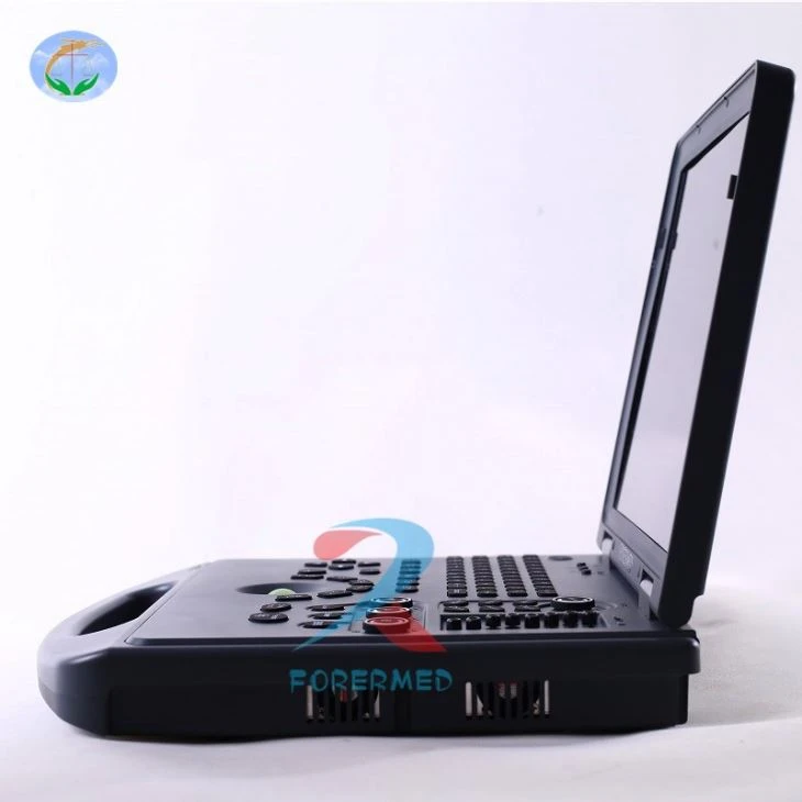 3D Doppler USG Scanner 3D Doppler USG Scanner