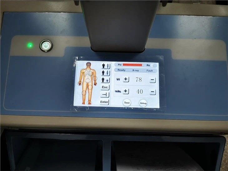 High Frequency Mobile Flat-panel Digital X-ray Radiography System