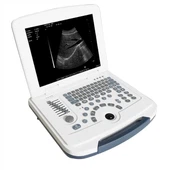 OB-GYN potpuno digitalni ultrazvučni sustav prijenosnog računala