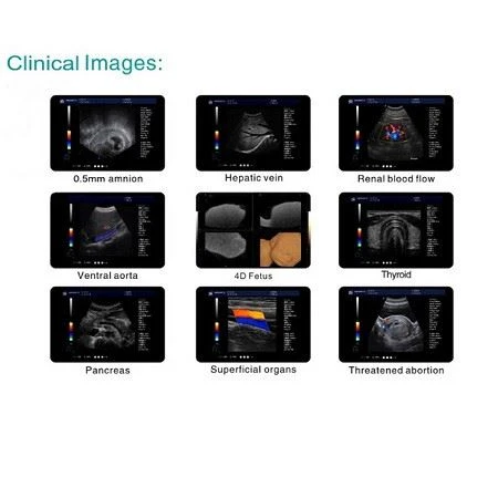 Full Digital Color Doppler Ultrasound Diagnostic System Full Digital Color Doppler Ultrasound Diagnostic System