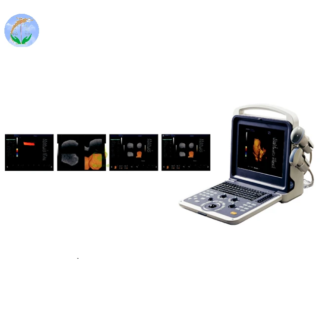 4D Color Doppler Full Digital Color Doppler Ultrasound Diagnostic System 4D Color Doppler Full Digital Color Doppler Ultrasound Diagnostic System